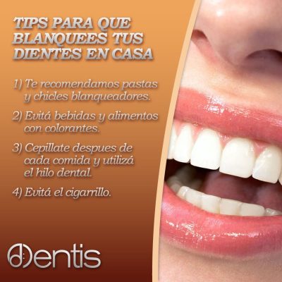 blanqueo de dientes - Dentis