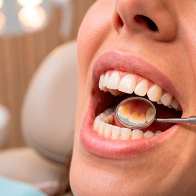 Dentis-agosto-26